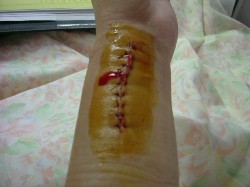 Hosp15.JPG 40KB